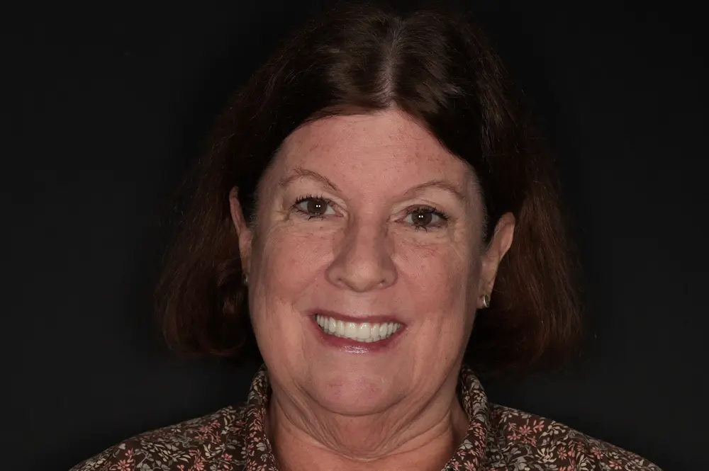 A woman with short brown hair smiles at the camera against a black background. She is wearing a patterned top.