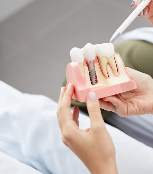 Dental model showing a dental implant and natural teeth; a hand points with a pen-like tool.